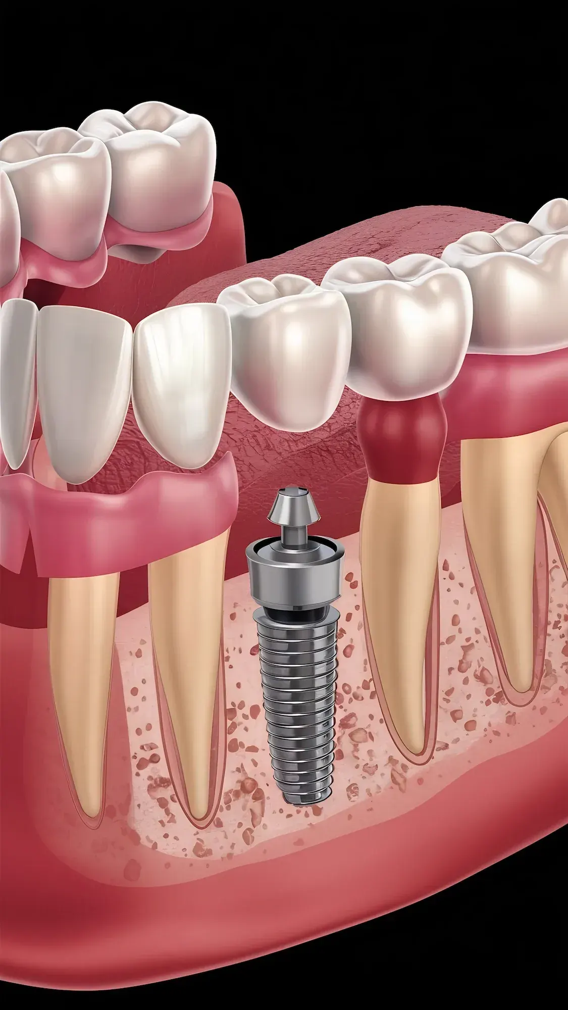 Confident patient considering All-on-X full-arch implants at a consultation