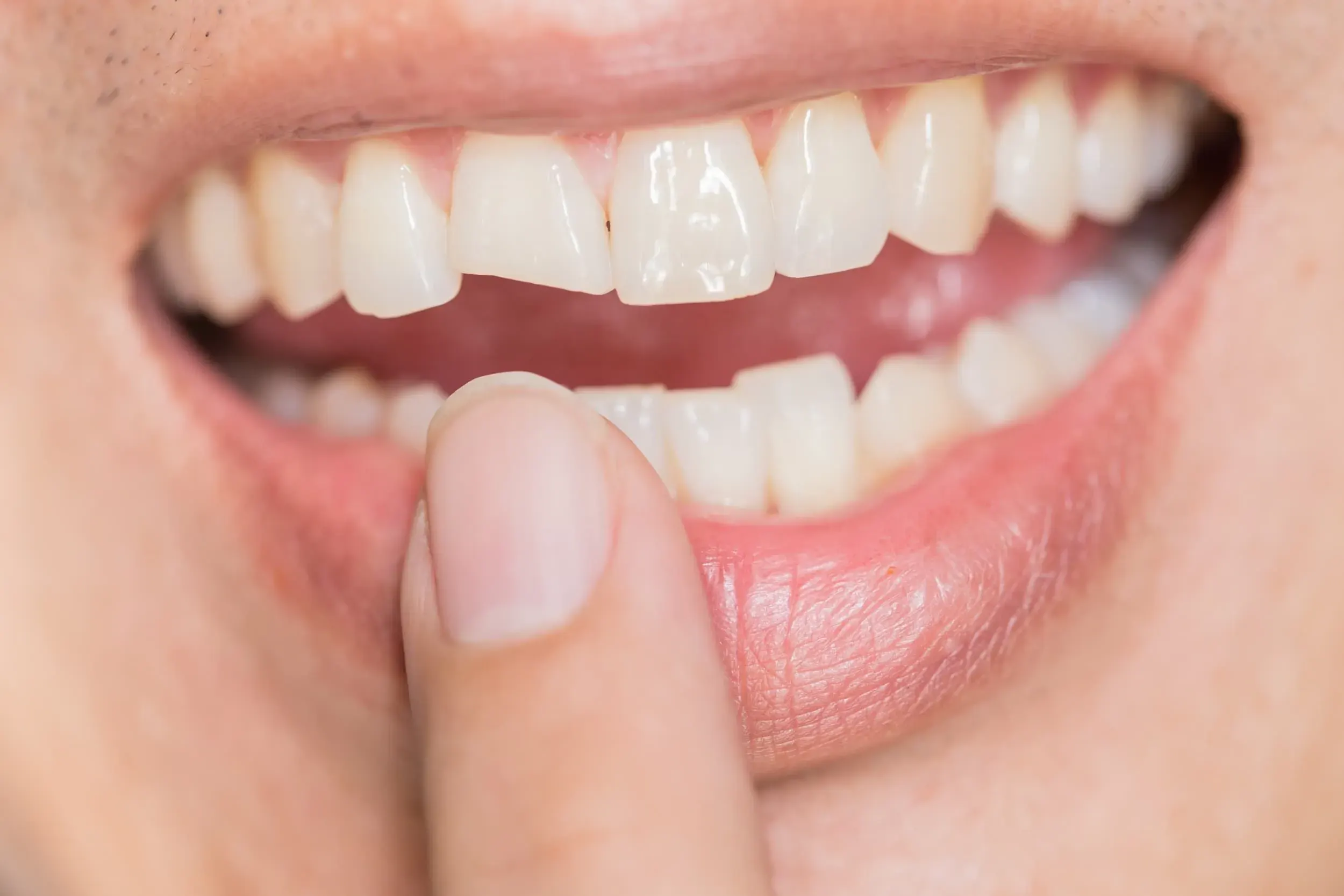 Patient consulting Dr. Cook about a broken or cracked tooth in Santa Rosa Beach, FL