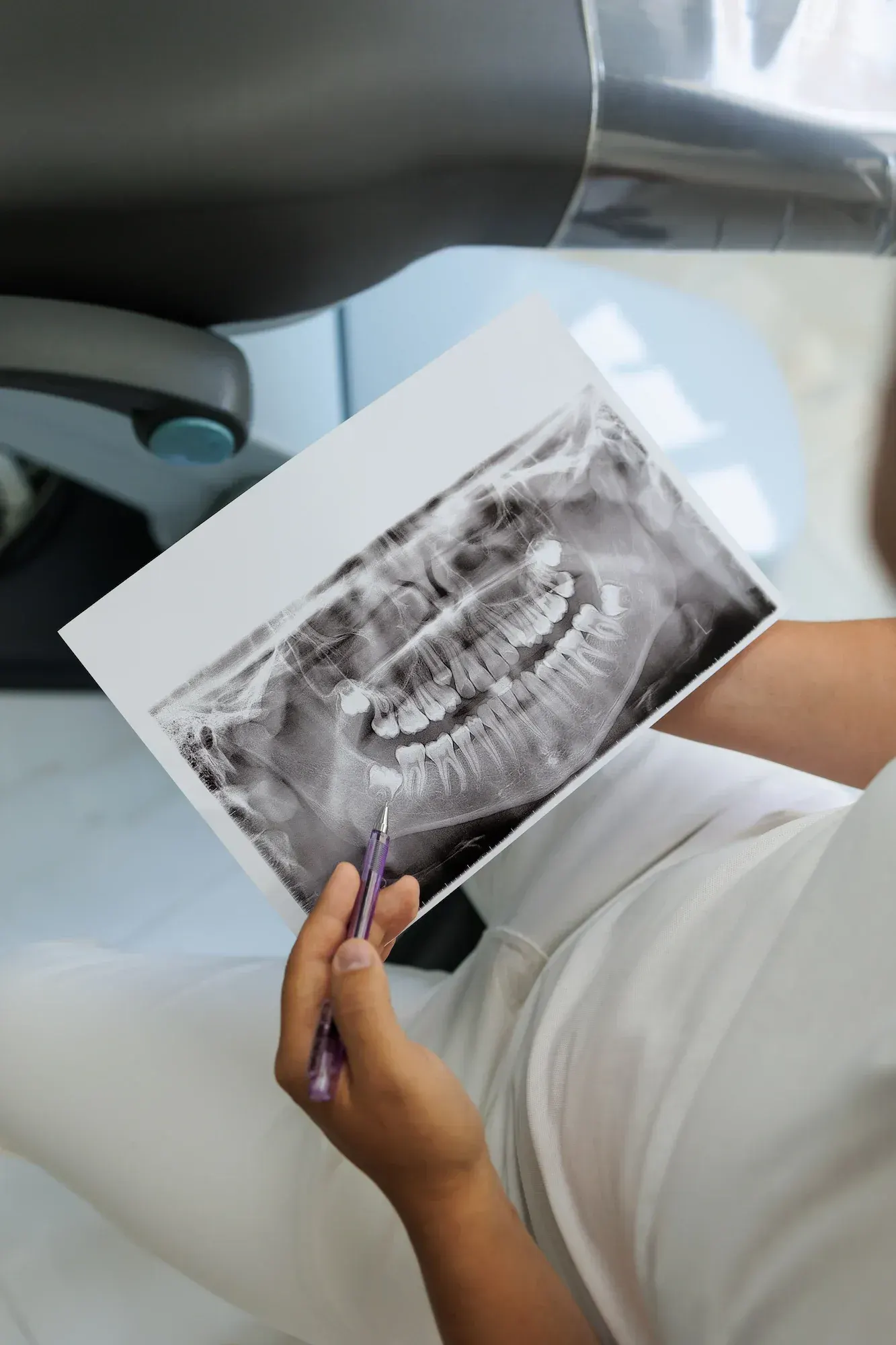 Side by side comparison of a 2D panoramic X-ray and a 3D CBCT scan of the upper jaw