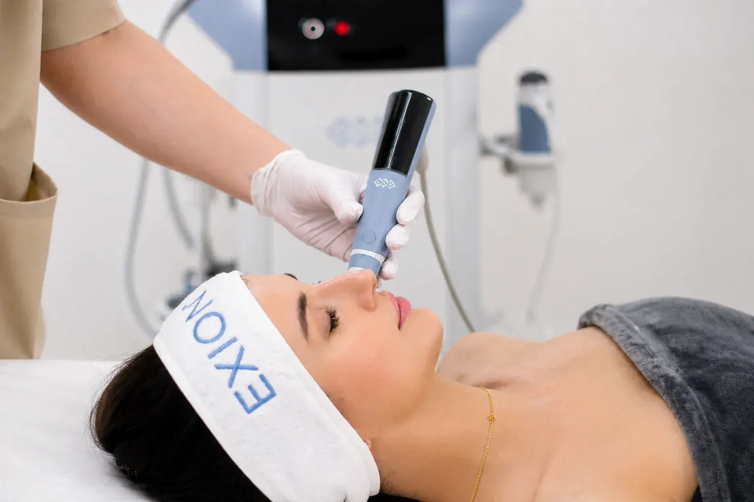 Before and after Exion microneedling skin rejuvenation