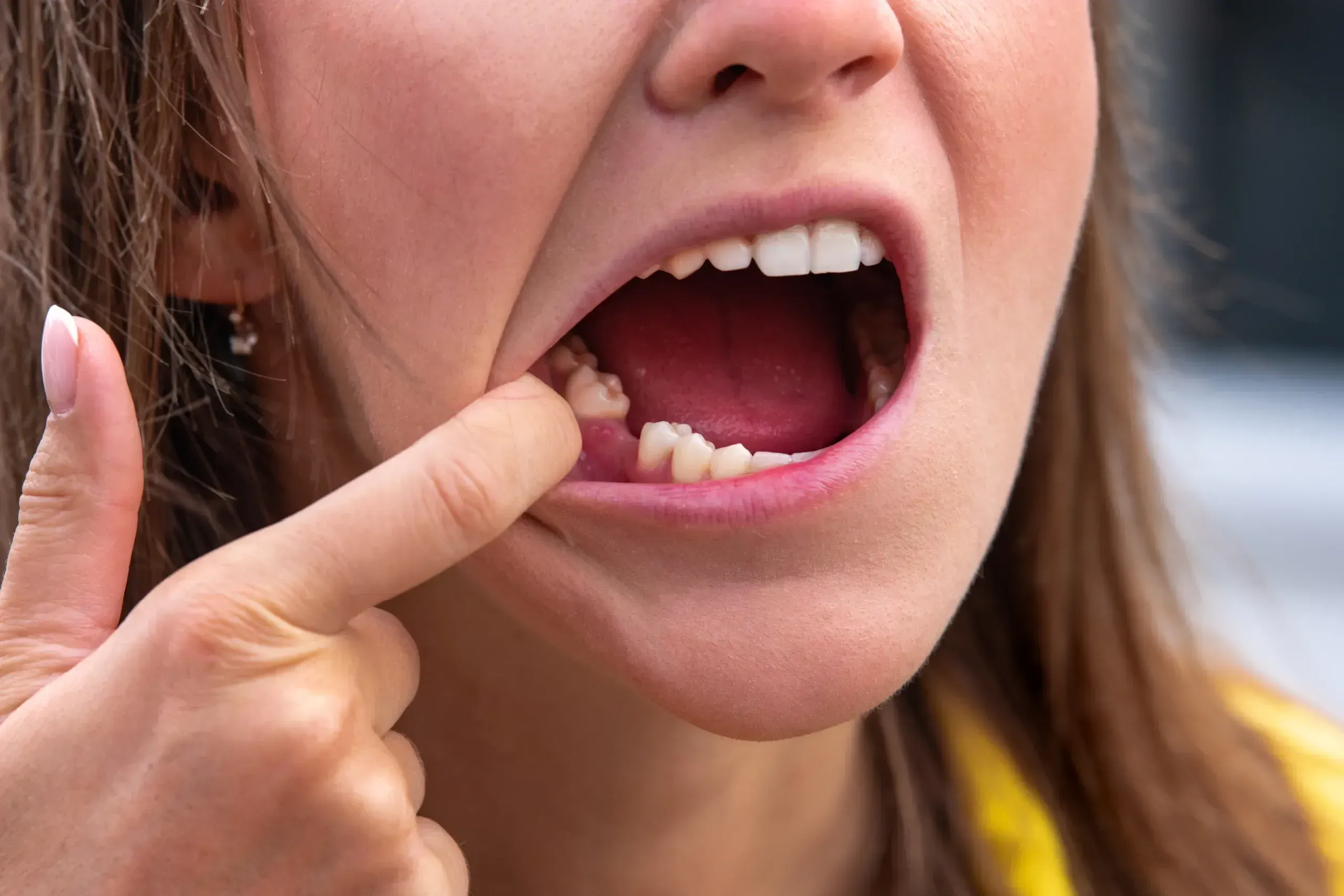 Patient considering tooth replacement options at Cook Family Dentistry