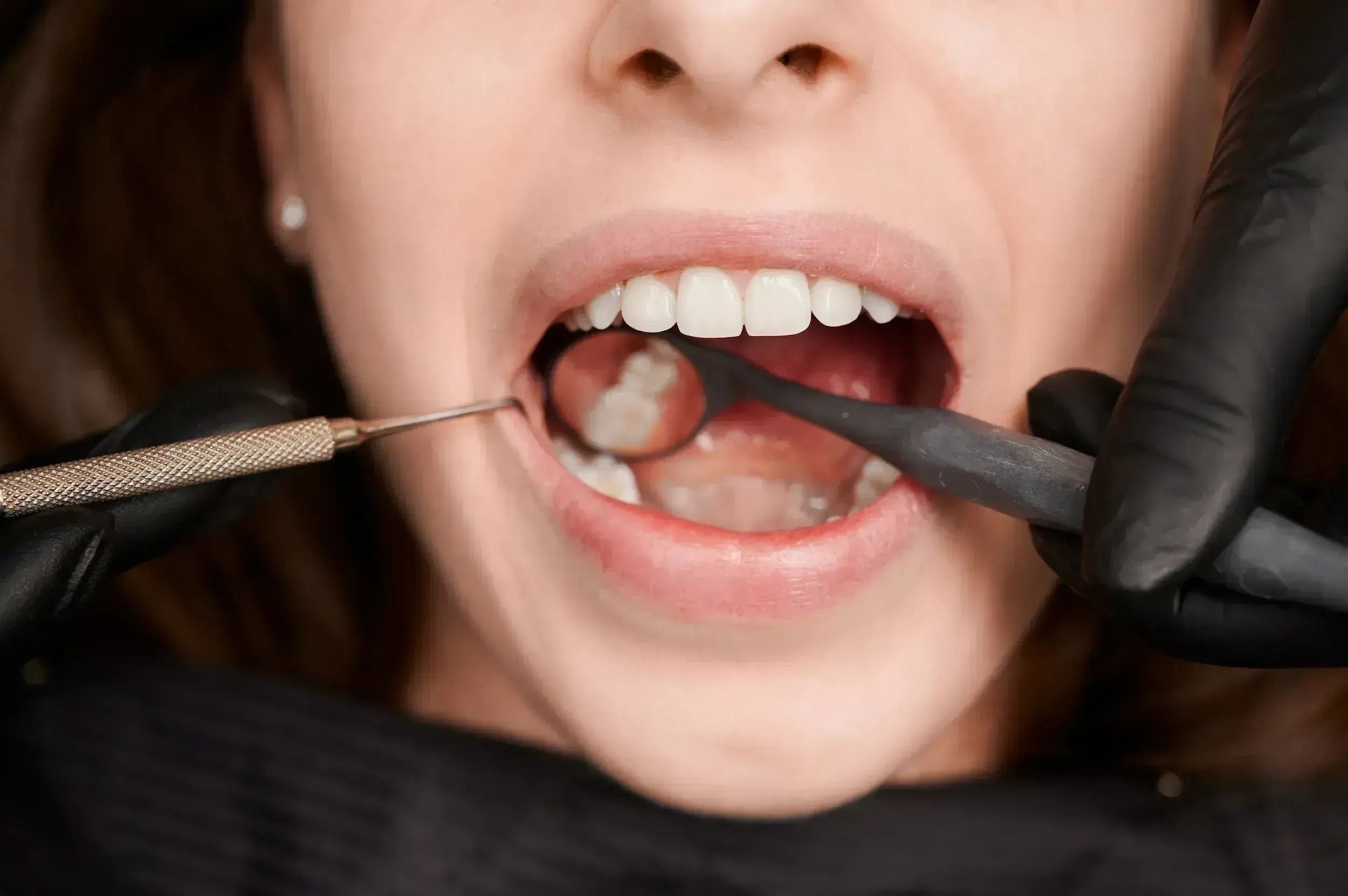 Before and after illustration of an infected tooth restored through root canal therapy and a custom crown
