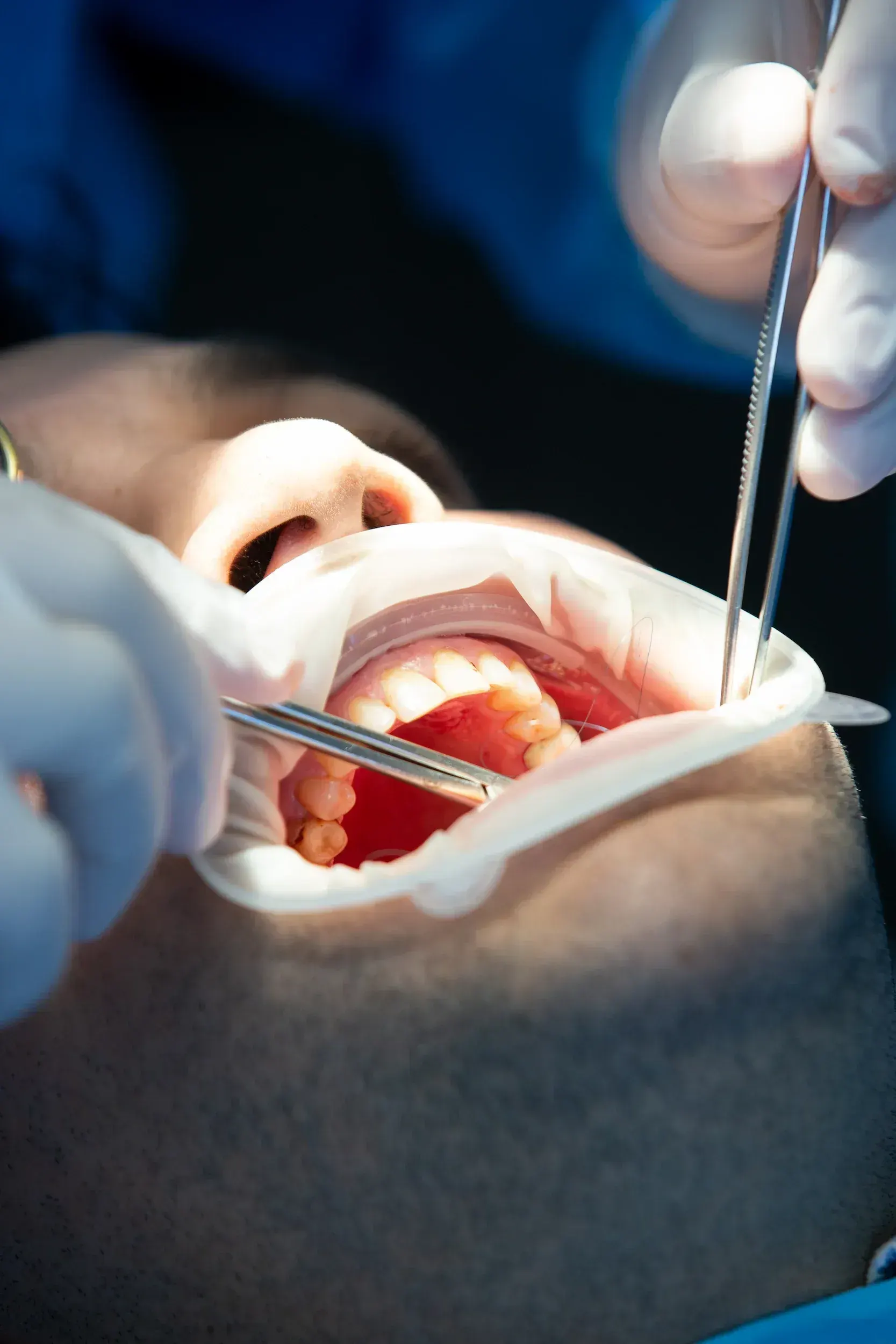 Confident patient ready for a planned tooth extraction