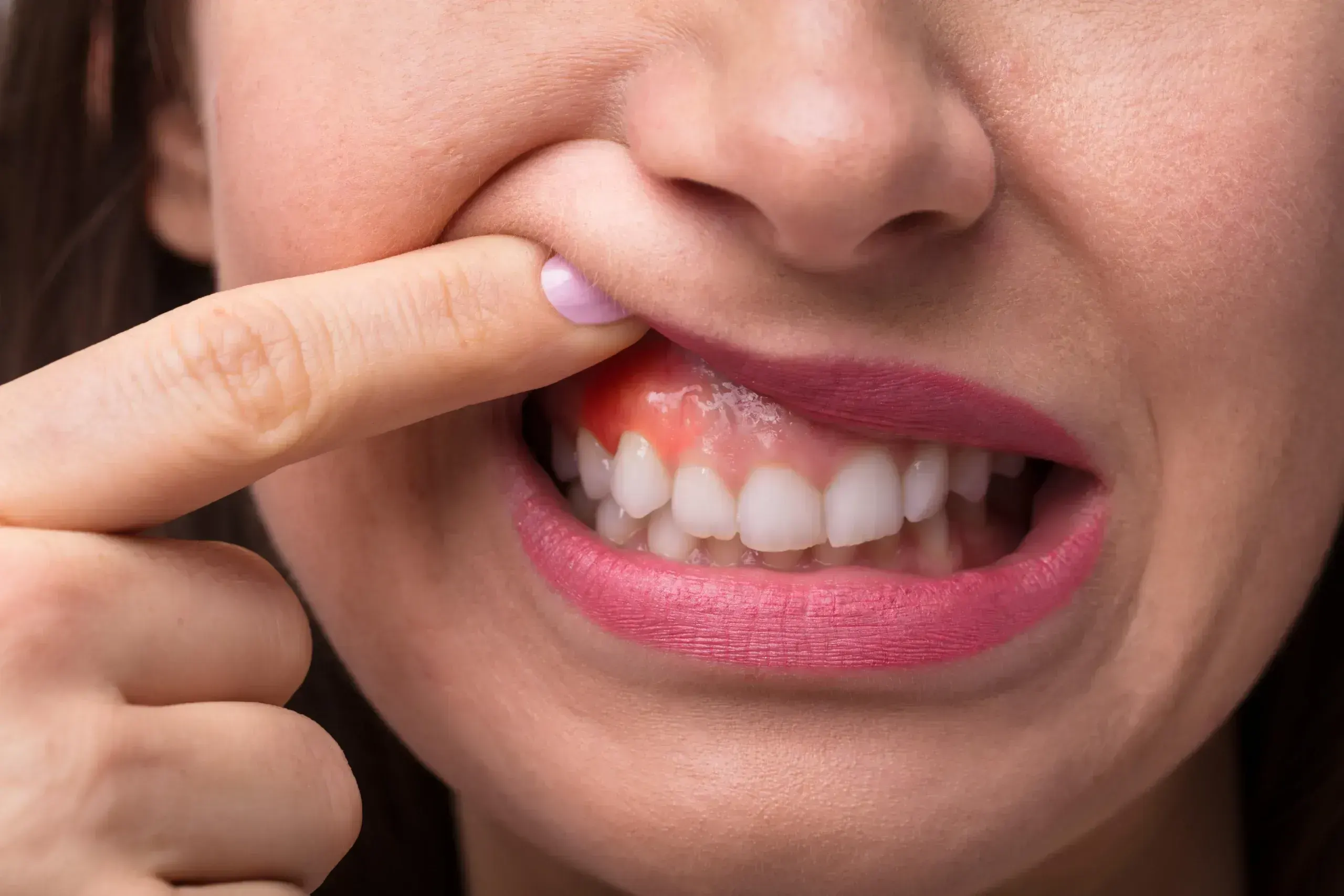 Tooth Sensitivity in Santa Rosa Beach, FL